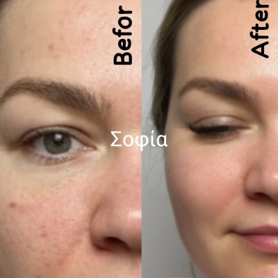 Φυτική Κρέμα Ημέρας με Έκκριμα Σαλιγκαριού – 50ml