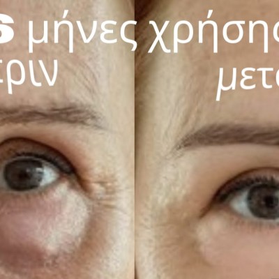 Βραδινή Κρέμα Ματιών – Αντιγήρανση & Αναζωογόνηση