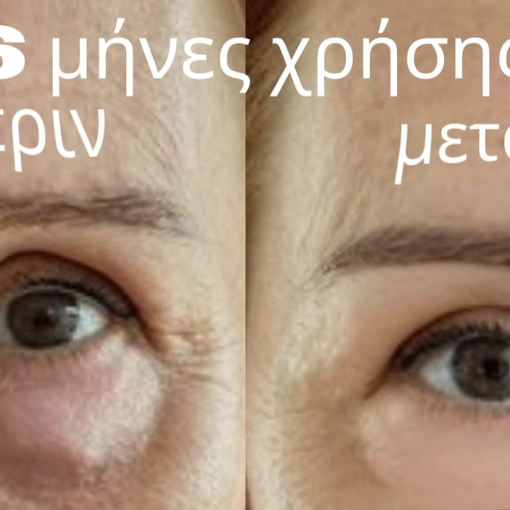 Βραδινή Κρέμα Ματιών – Αντιγήρανση & Αναζωογόνηση