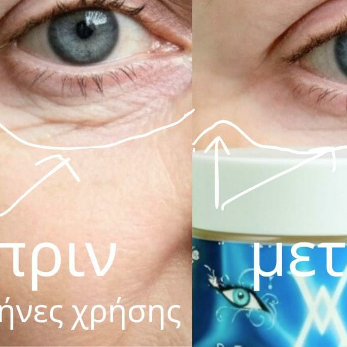 Βραδινή Κρέμα Ματιών – Αντιγήρανση & Αναζωογόνηση